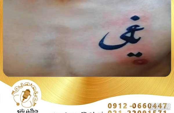 تاتو یاغی - دکتر تاتو ایران تاتو یاغی - دکتر تاتو ایران