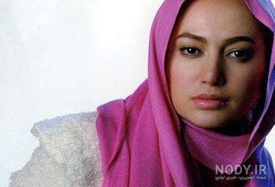 صبا کمالی قبل و بعد عمل زیبایی - عکس ویسگون صبا کمالی قبل و بعد عمل زیبایی - عکس ویسگون