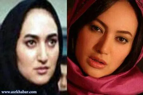 عکس قبل عمل صبا کمالی عکس قبل عمل صبا کمالی