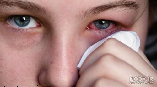 عکس های چشم زخم برای پروفایل ️ [ بهترین تصاویر ]