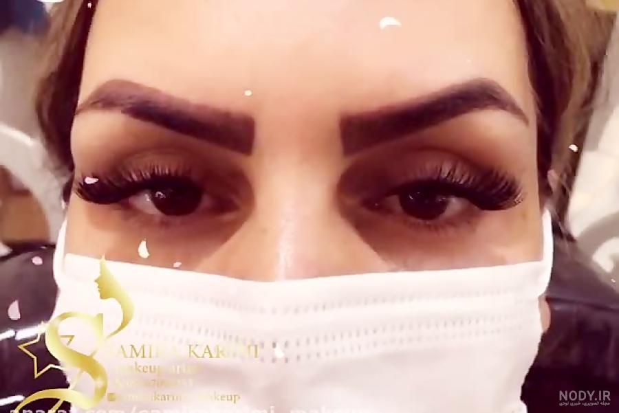 عکس کاشت خط لب عکس کاشت خط لب