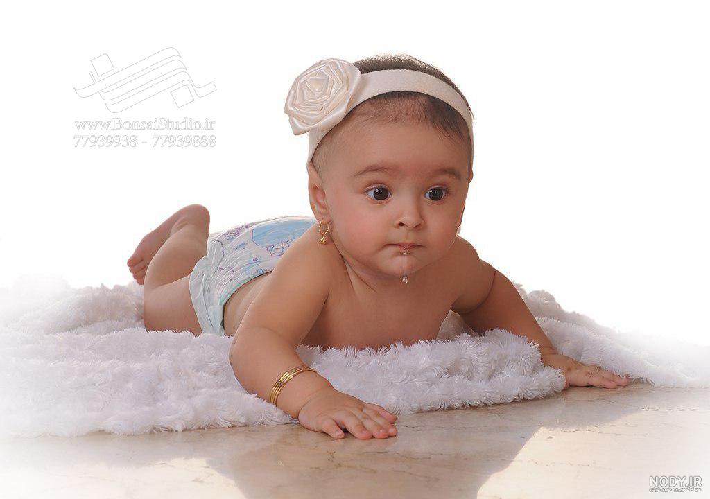 آخرین خبر | کودک ۱۷ ماهه‌ای که مبتلا به سندرم موهای شانه نشدنی است