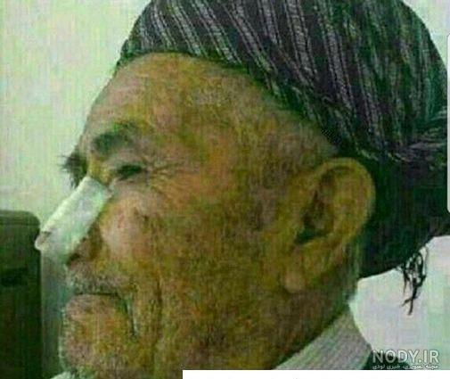 عکس خنده دار کچل