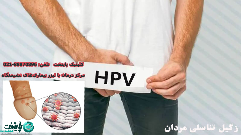 درمان اچ پی وی 16 چیست؟ | دکتر انتظاری متخصص زگیل تناسلی
