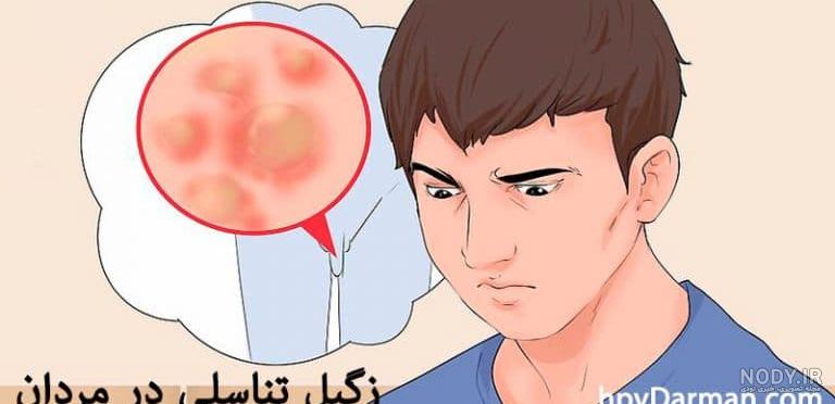 علائم hpv در زنان چیست؟ | دکتر حسین کرمی