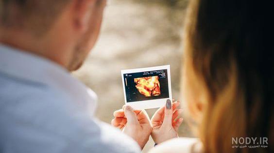 ایده برای عکس سونوگرافی - عکس نودی