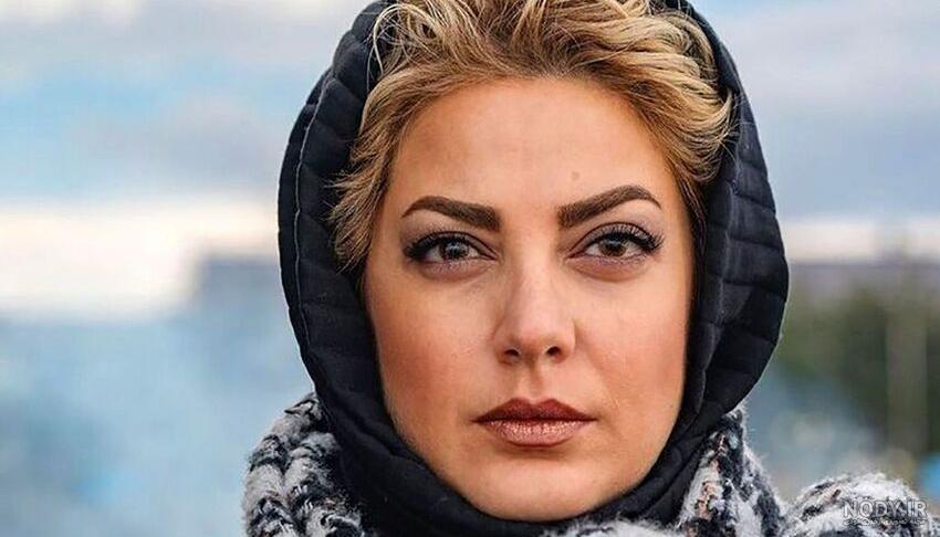 بالاترین: عکس چهره طناز طباطبایی قبل و بعد از جراحی زیبایی بینی! بالاترین: عکس چهره طناز طباطبایی قبل و بعد از جراحی زیبایی بینی!