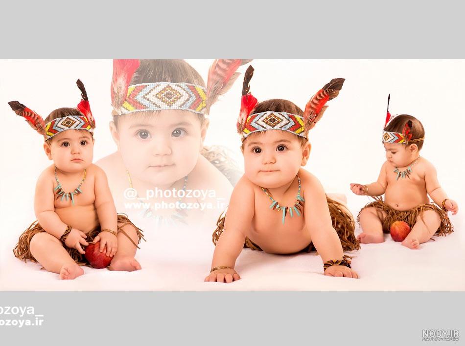 عجیب ترین کودک سیاه پوست جهان + عکس