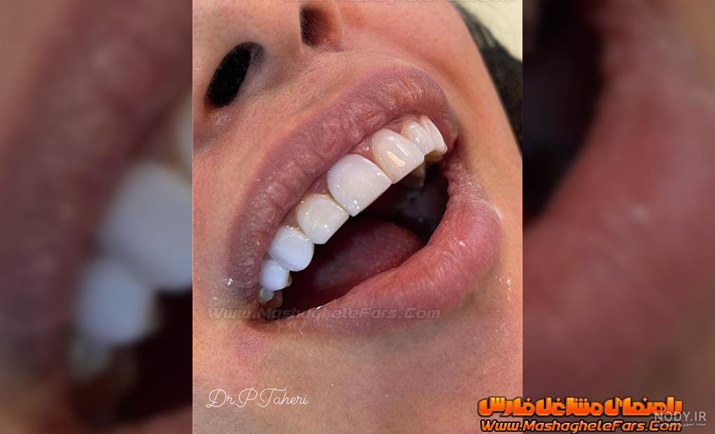 عکس هایی از تمرینات یوگای شیوا طاهری شیواطاهری شیوا طاهری یوگا ورزش ... عکس هایی از تمرینات یوگای شیوا طاهری شیواطاهری شیوا طاهری یوگا ورزش ...