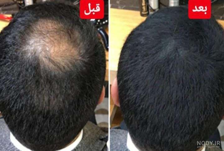 استوری امروز بازیگران ، هنرمندان و ورزشکاران در اینستاگرام استوری امروز بازیگران ، هنرمندان و ورزشکاران در اینستاگرام