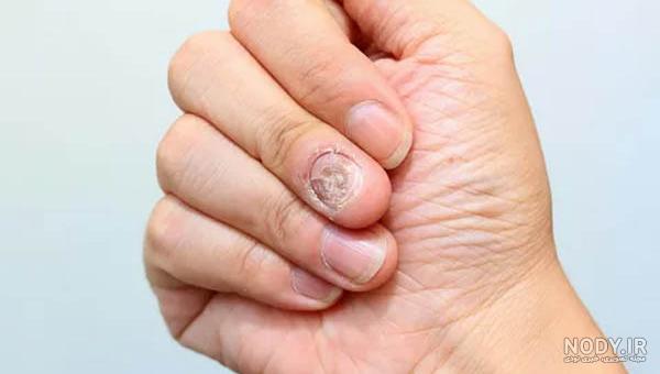 فرمول ترکیب رنگ 5 هایلایت عسلی روی موی قهوه‌ای - مجله وبسایت آچاره