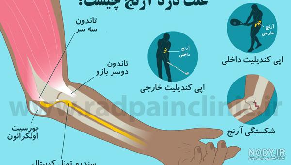 عکس تاتو روی ارنج دست عکس تاتو روی ارنج دست