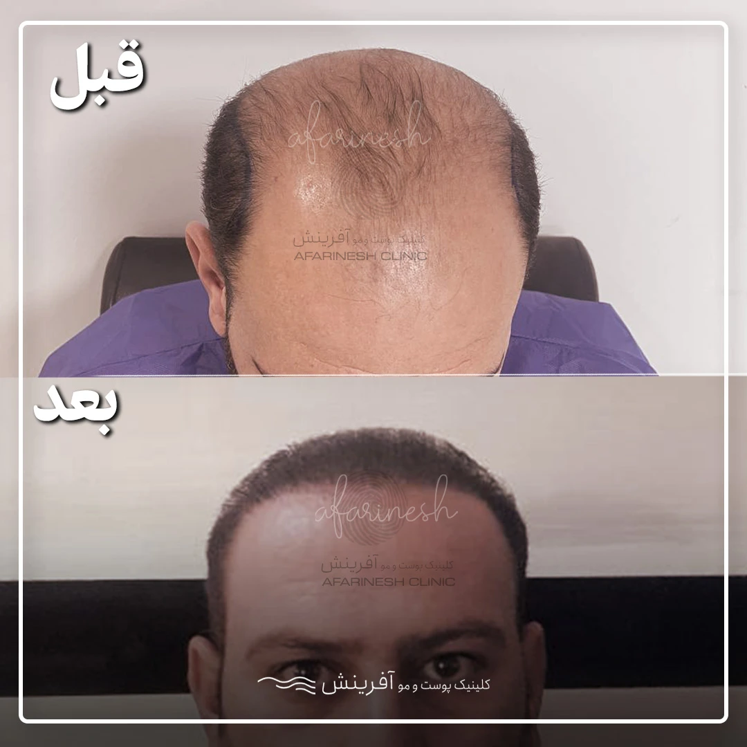 معرفی دقیق اجزای ساختمان مو – مجله آسان طب معرفی دقیق اجزای ساختمان مو – مجله آسان طب