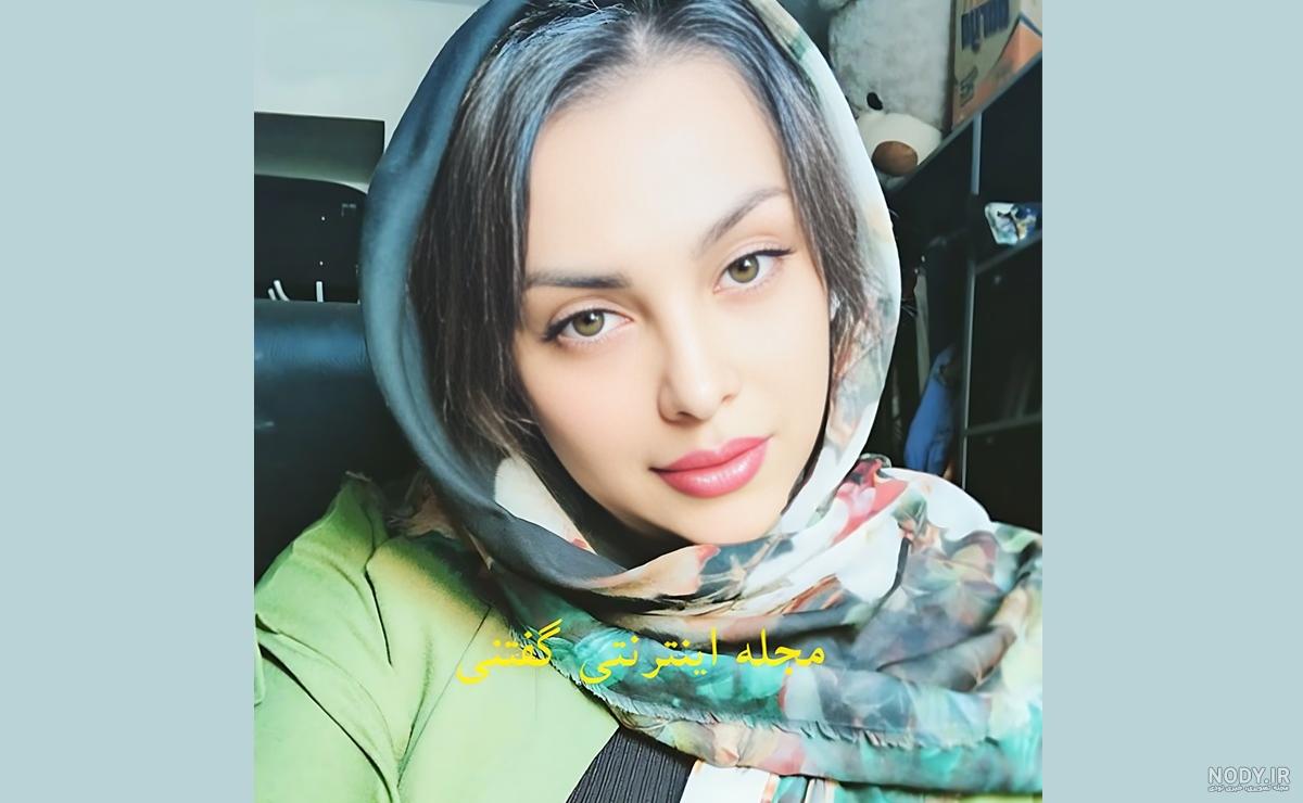 تغییر چهره ۱۸۰ درجه ای شایان افضلی بعد از تغییر جنسیت و بازیگر ...