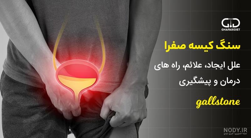 سنگ کيسه صفرا سنگ کيسه صفرا