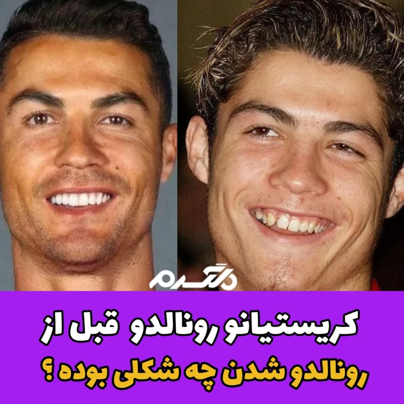 عکس رونالدو قبل و بعد