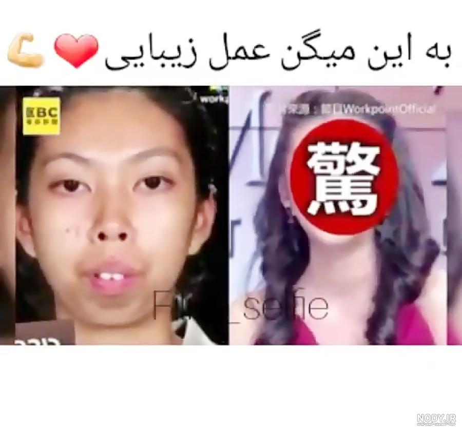 اعضای بلک پینک قبل.و بعد عمل - نماشا