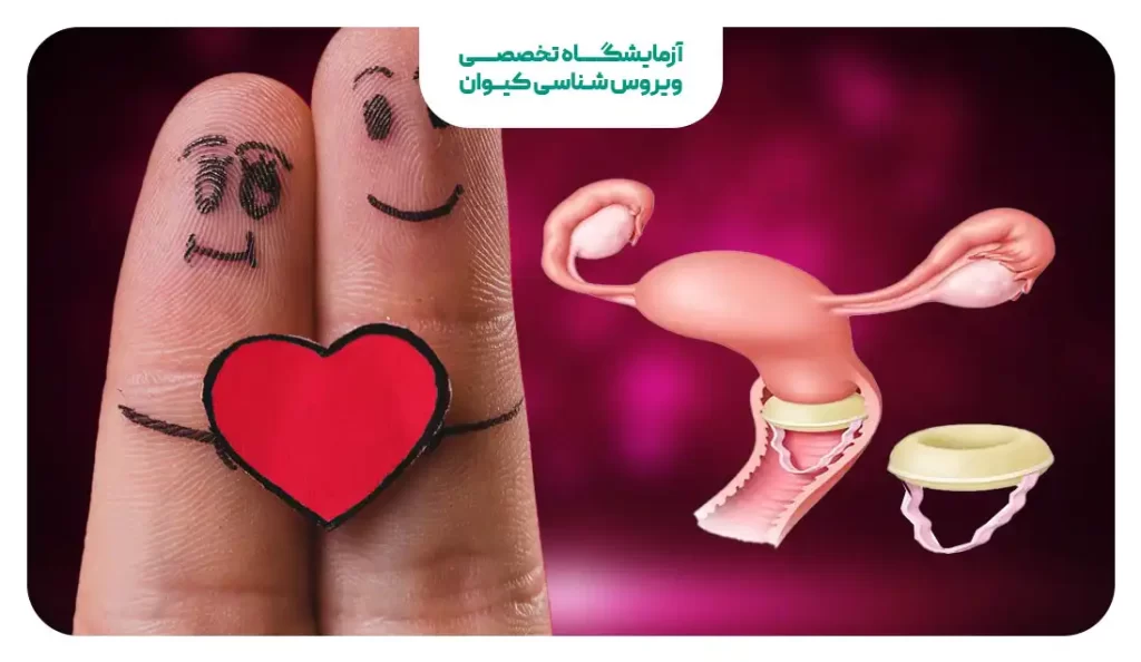 بهترین روش جلوگیری از بارداری بعد از ازدواج - سلامت بانوان اوما بهترین روش جلوگیری از بارداری بعد از ازدواج - سلامت بانوان اوما