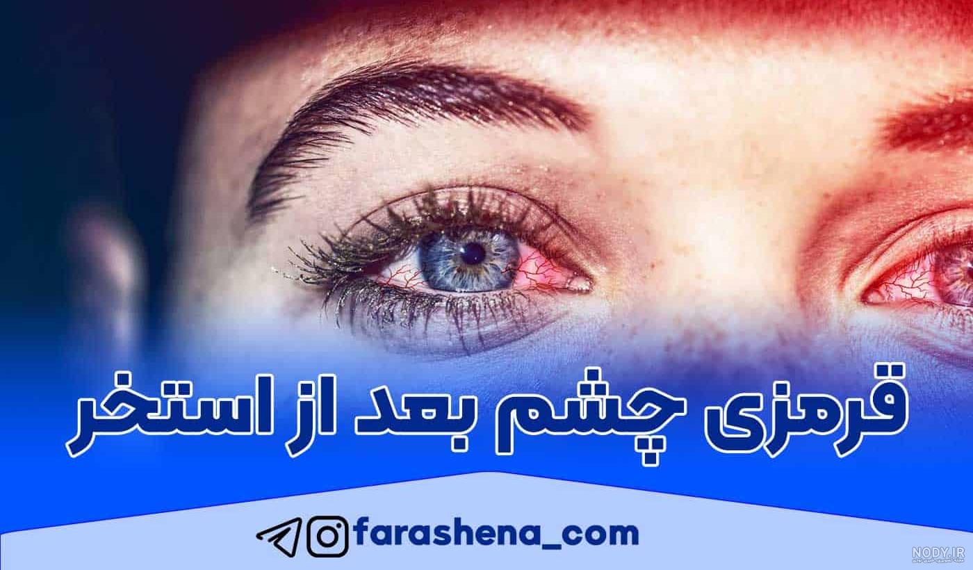 عکس قرمز شدن چشم - عکس نودی عکس قرمز شدن چشم - عکس نودی