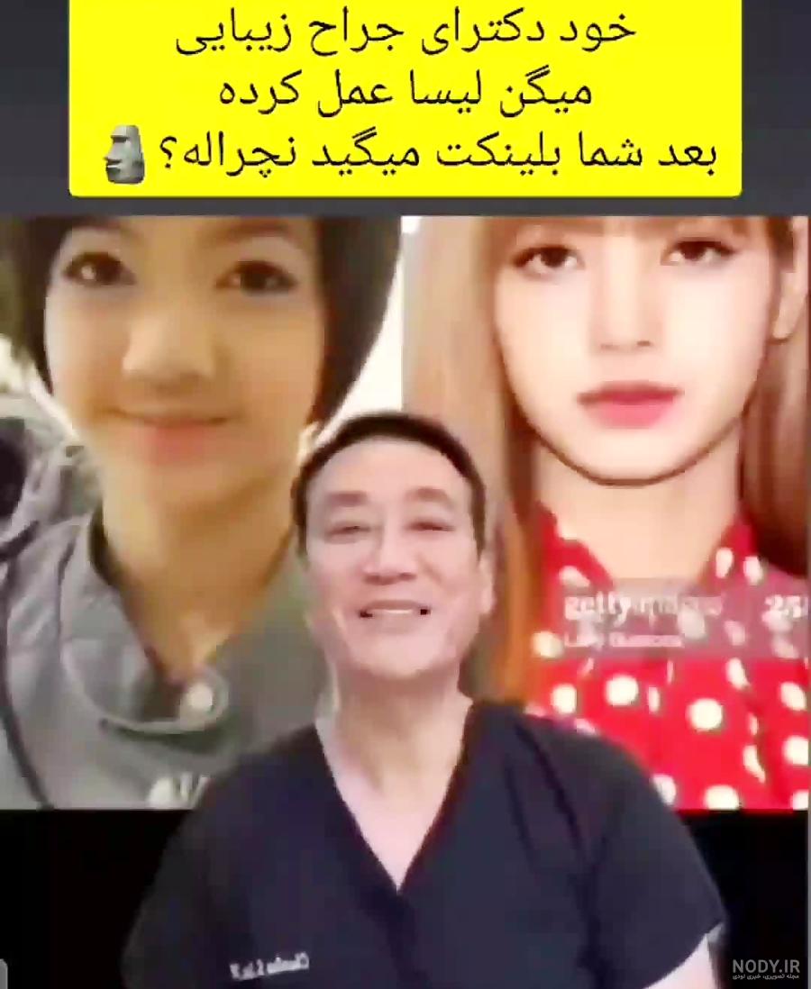 عکس لیسا مانوبان قبل از عمل - عکس نودی