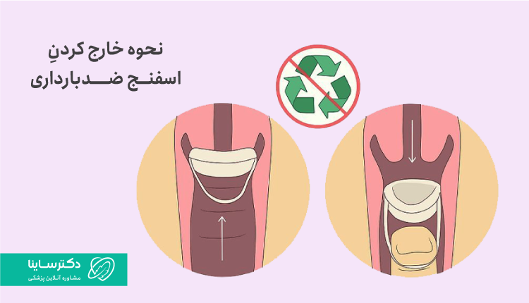 مزایا و معایب استفاده از اسفنج ضد بارداری چیست؟ | مجله سلامت کیوان مزایا و معایب استفاده از اسفنج ضد بارداری چیست؟ | مجله سلامت کیوان