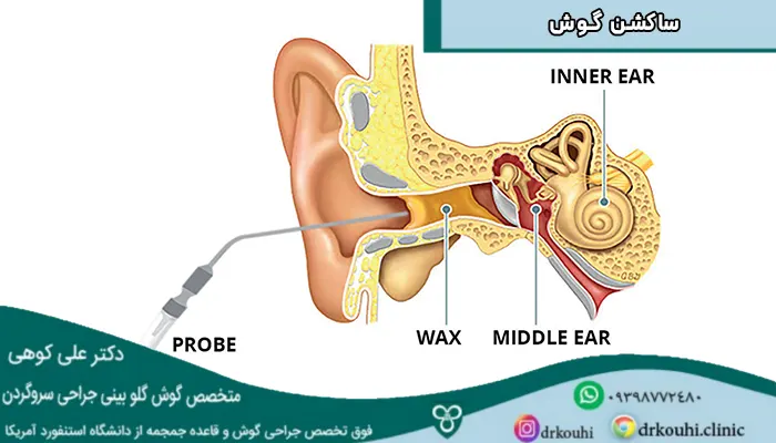 توي توي عکس گوشواره دختر کفشدوزکی توي توي عکس گوشواره دختر کفشدوزکی