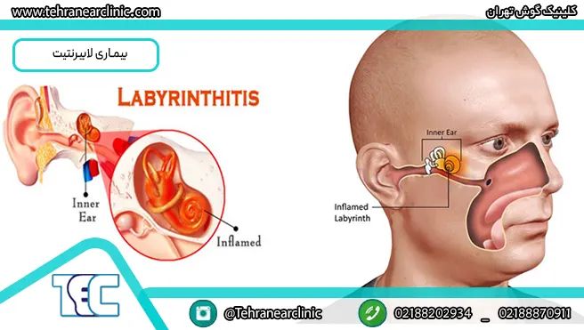 عکس توی گوش عکس توی گوش