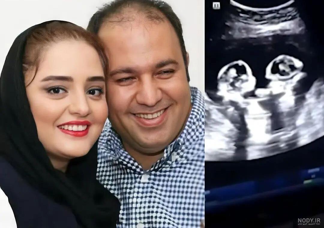 بیوگرافی علی اوجی + تصاویر عاشقانه علی اوجی و همسرش بیوگرافی علی اوجی + تصاویر عاشقانه علی اوجی و همسرش