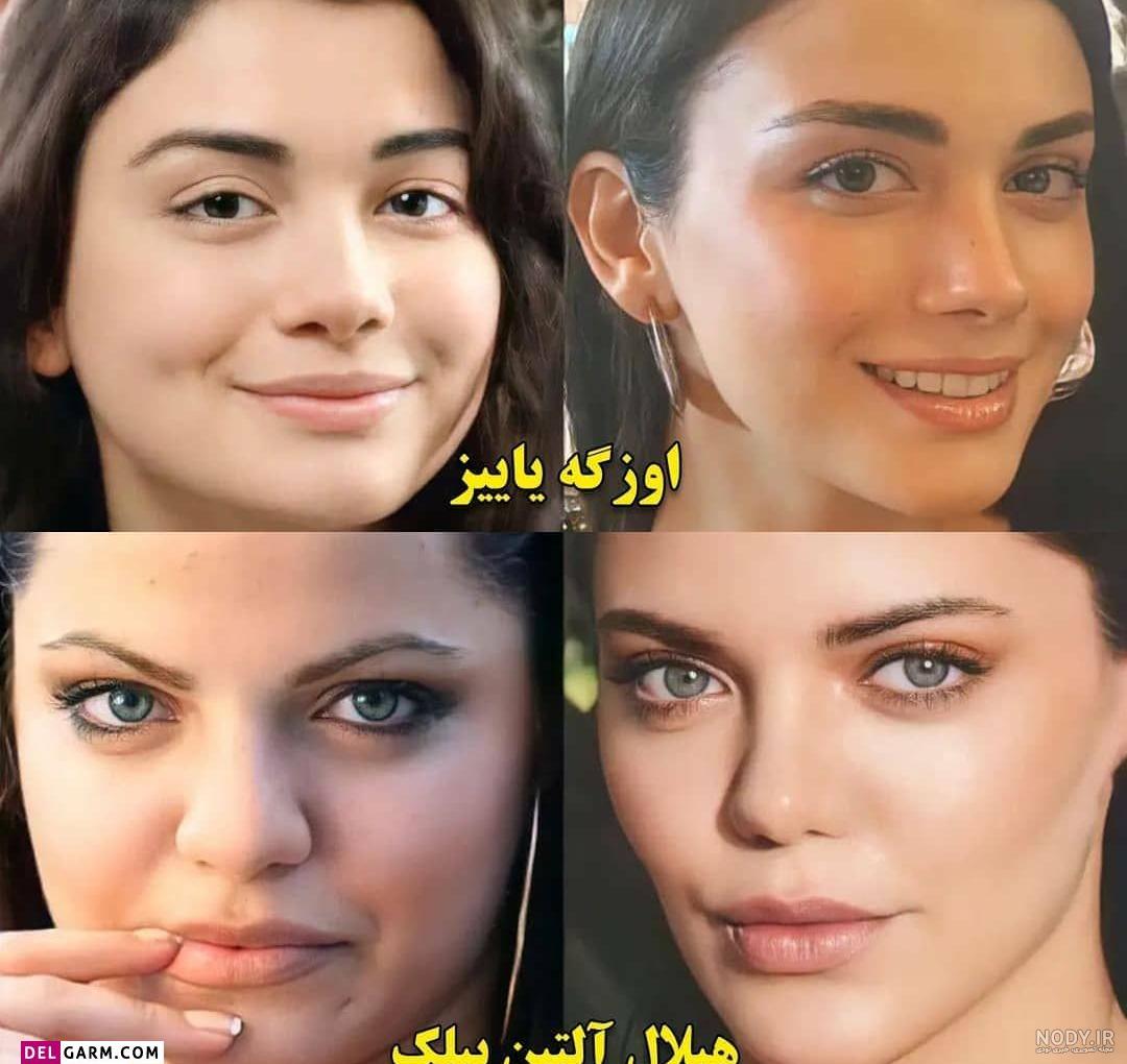 بیوگرافی هانده ارچل و همسرش + عکس های قبل از عمل و بدون ارایش بیوگرافی هانده ارچل و همسرش + عکس های قبل از عمل و بدون ارایش