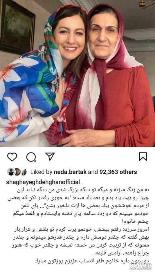 شقایق یزدانی** - عکس ویسگون شقایق یزدانی** - عکس ویسگون