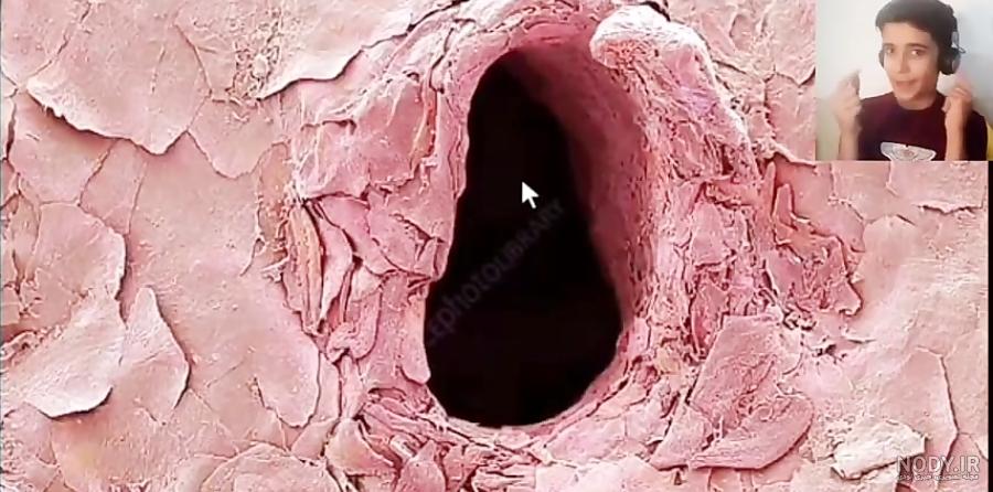 عکس صورت سوسک زیر میکروسکوپ