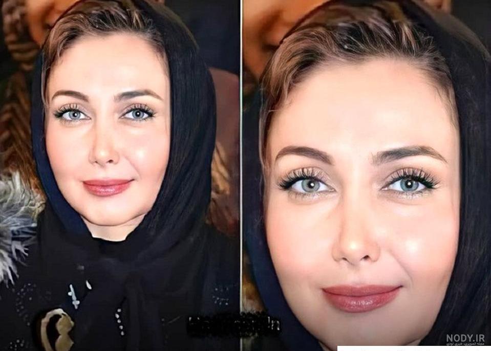 بیوگرافی هلال آلتینبیلک + عکس قبل از عمل - زیبامون بیوگرافی هلال آلتینبیلک + عکس قبل از عمل - زیبامون