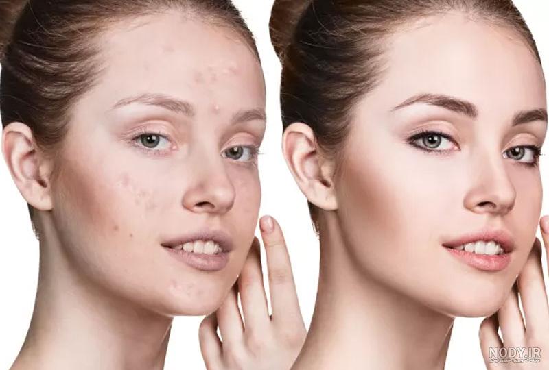ترفندهای ادیت و ویرایش کردن عکس | ⭐️ روش سریع روتوش پوست در فتوشاپ