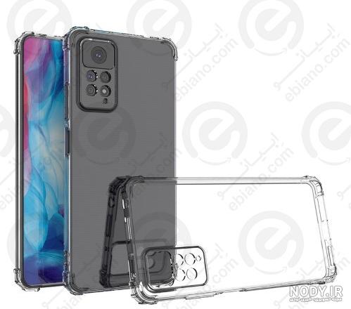 Xiaomi Redmi Note 11 - تصاویر گوشی شیائومی ردمی نوت 11 | mobile.ir - مرجع موبایل ایران Xiaomi Redmi Note 11 - تصاویر گوشی شیائومی ردمی نوت 11 | mobile.ir - مرجع موبایل ایران