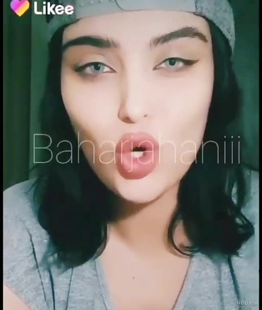 عکس بهار جهانی قبل از عمل عکس بهار جهانی قبل از عمل