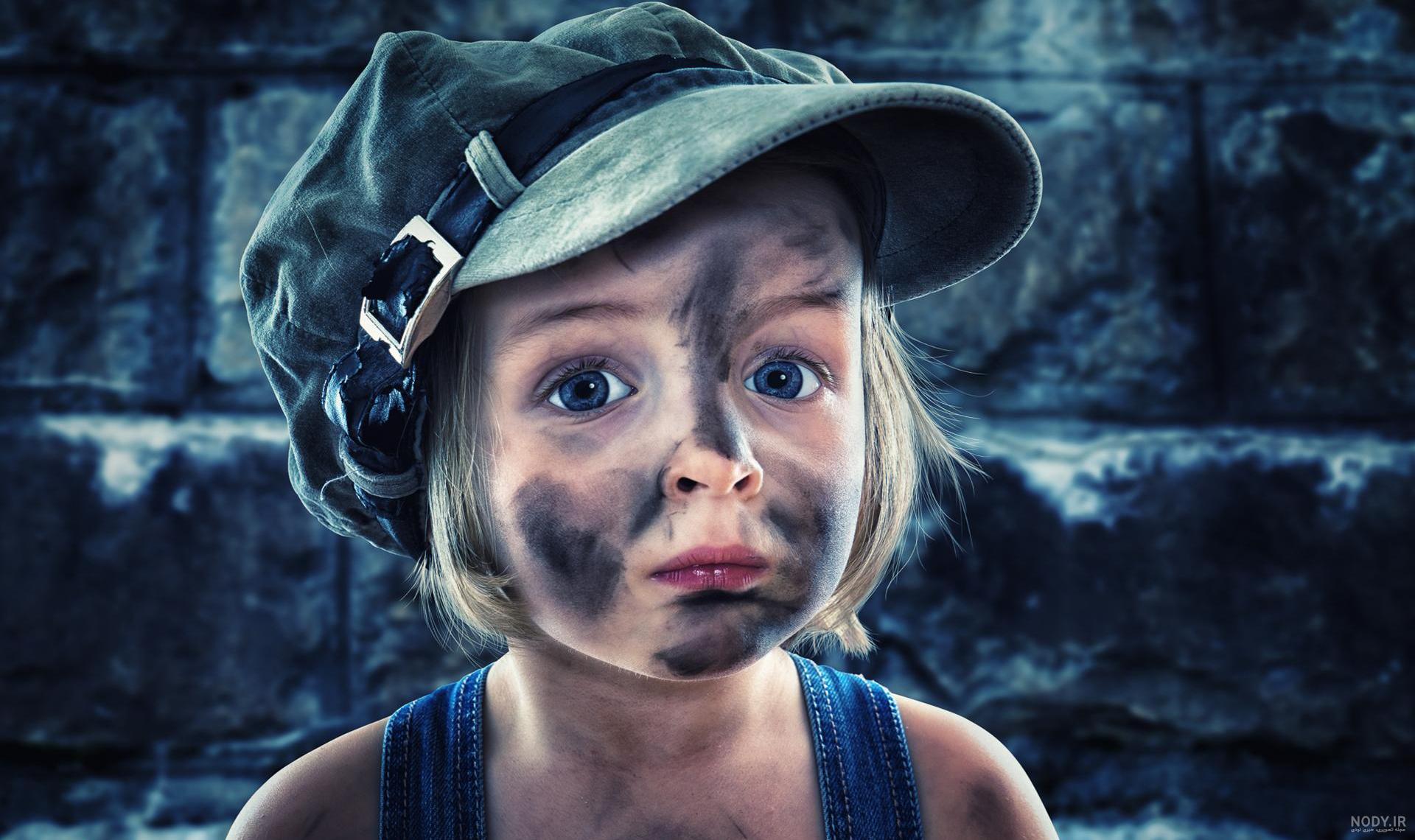 عکس بچه زشت