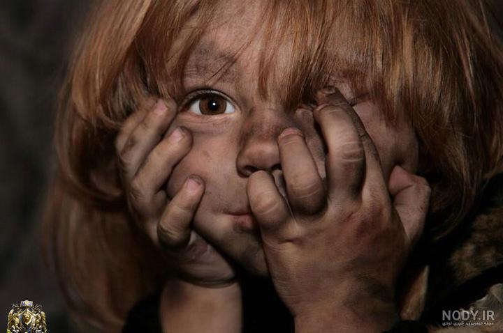 عکس پسر بچه زشت