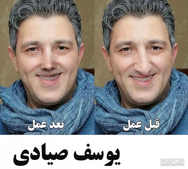 عکس قبل و بعد عمل بینی 3 بازیگر محبوب / آنها به دماغشان معروف هستند! عکس قبل و بعد عمل بینی 3 بازیگر محبوب / آنها به دماغشان معروف هستند!