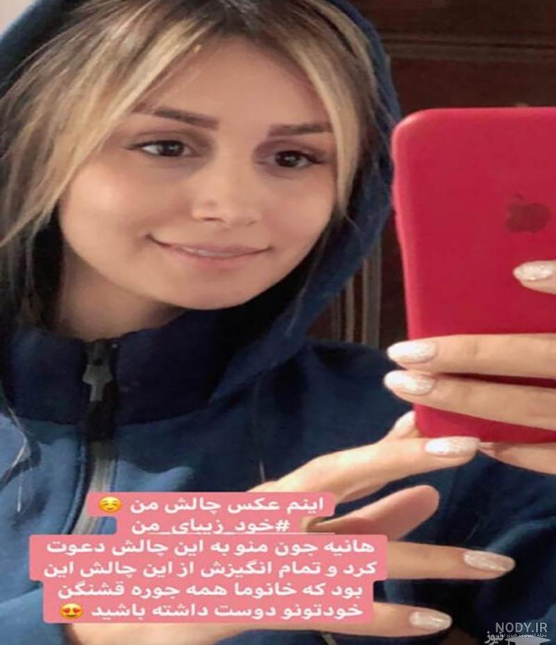 عکس قبل و بعد عمل بینی شاهرخ استخری - دکتر محمد صوفی زاده عکس قبل و بعد عمل بینی شاهرخ استخری - دکتر محمد صوفی زاده