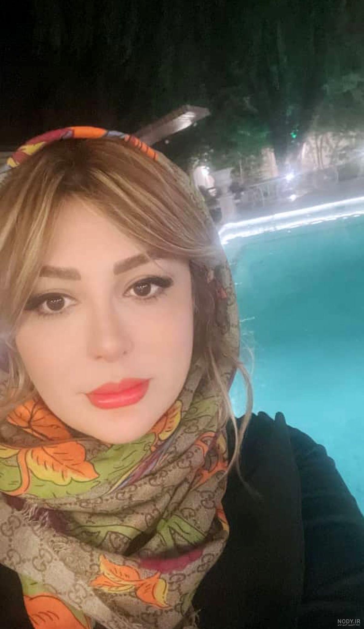 تغییر چهره عجیب نیوشا ضیغمی بعد از عمل زیبایی+عکس تغییر چهره عجیب نیوشا ضیغمی بعد از عمل زیبایی+عکس