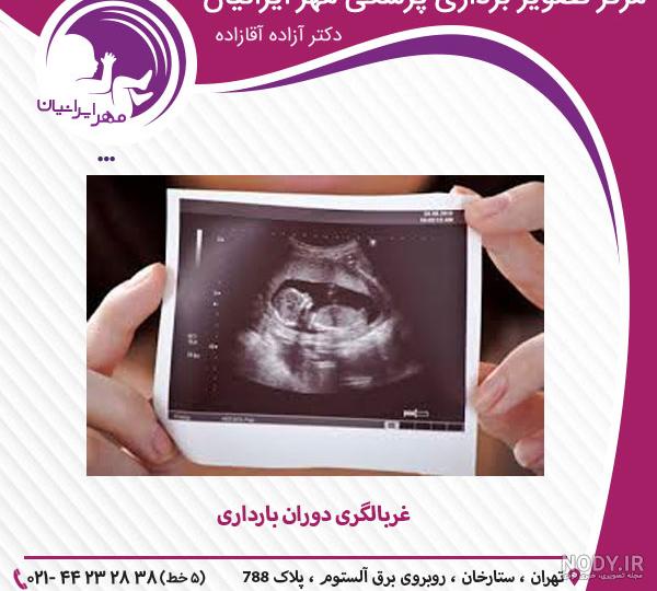 عکس جنین در هفته شانزدهم بارداری تصویر و اندازه جنین | نی نی پلاس عکس جنین در هفته شانزدهم بارداری تصویر و اندازه جنین | نی نی پلاس