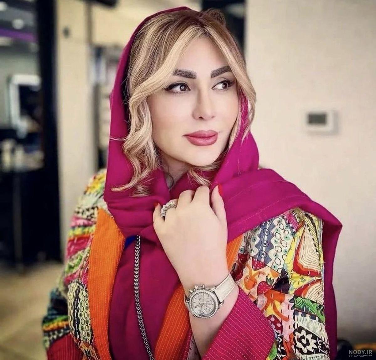 نیوشا ضیغمی پس از عمل دوم بینی اش + عکس نیوشا ضیغمی پس از عمل دوم بینی اش + عکس