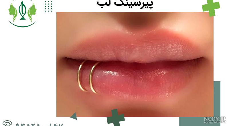 پیرسینگ لب | انواع | عوارض | قیمت 1403 + عکس ✔️ | مرکز زیبایی و لیزر