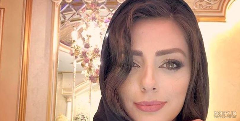 نفیسه روشن قبل و بعد از عمل زیبایی+عکس جنجالی نفیسه روشن قبل و بعد از عمل زیبایی+عکس جنجالی