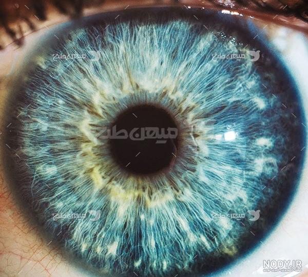 وضوح چشم انسان چند مگاپیکسل است؟ + عکس وضوح چشم انسان چند مگاپیکسل است؟ + عکس