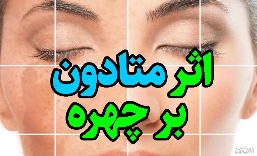 عکس رنگ متادون