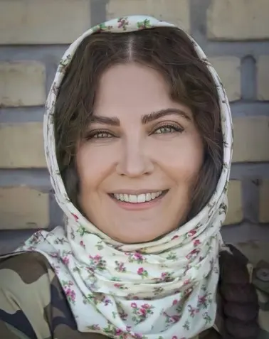 لعیا زنگنه چه بلایی سر چهره خود آورده ؟/ باورکردنی نیست! +عکس لعیا زنگنه چه بلایی سر چهره خود آورده ؟/ باورکردنی نیست! +عکس
