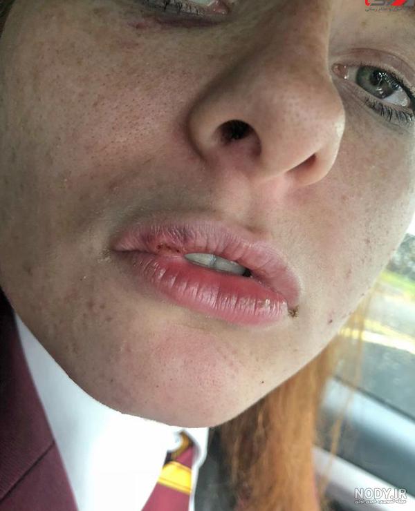 عکس های زیباترین دختر افغانستان