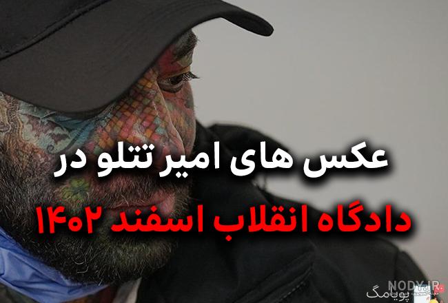 فوری . اولین تصویر لو رفته از داخل زندان تتلو و انتقال تتلو به بیمارستان  بعد شکنجه و اعتراف اجباری