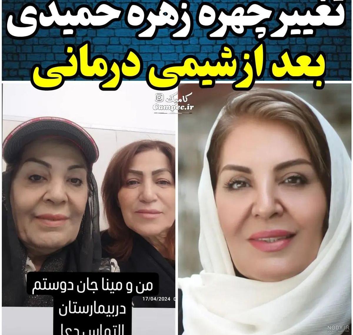عکس باورنکردنی عروسی زهره حمیدی ! / خانم بازیگر الان جذاب تر است ! + عکس  پرآرایش جدید